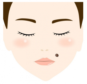 ほくろの治療（除去） |【公式】わかば皮ふ形成クリニック広島市安佐南