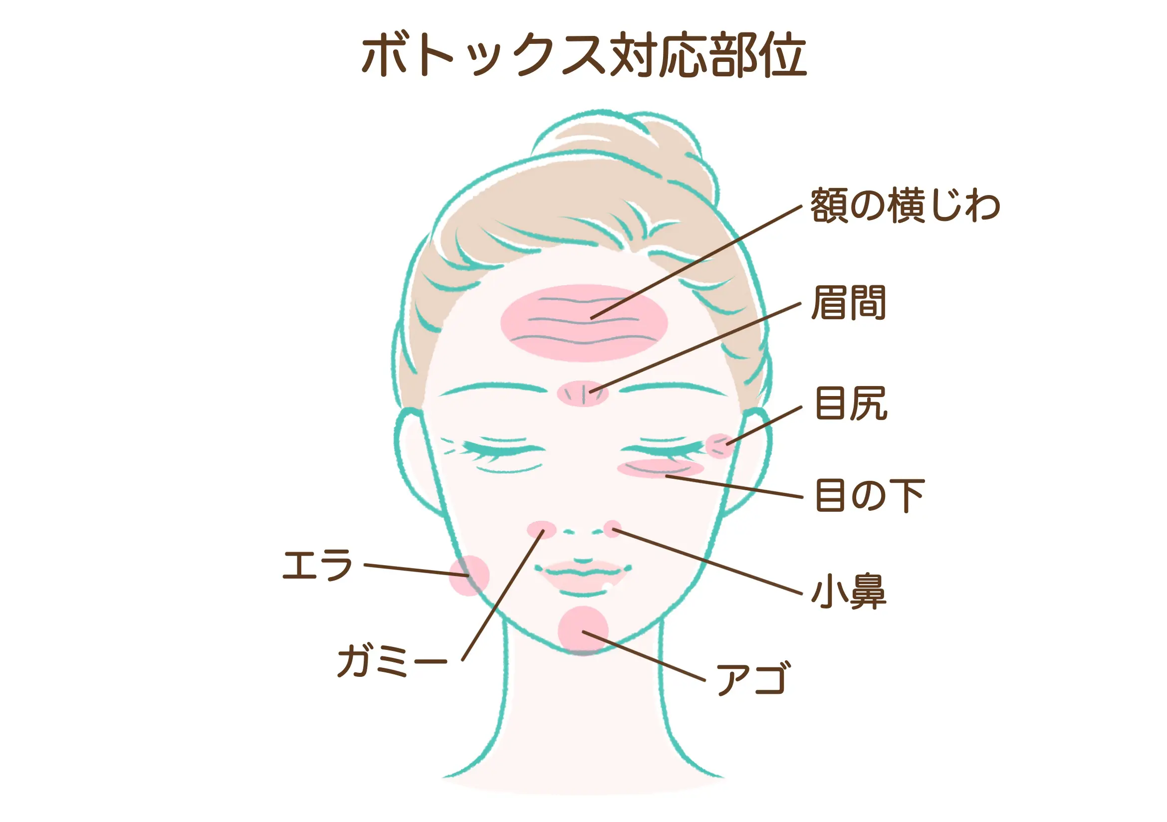 ボツリヌス注射 |【公式】わかば皮ふ形成クリニック広島市安佐南区の